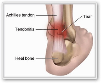 Injury FAQ